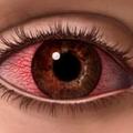 Гигиена зрения: как правильно ухаживать за глазами